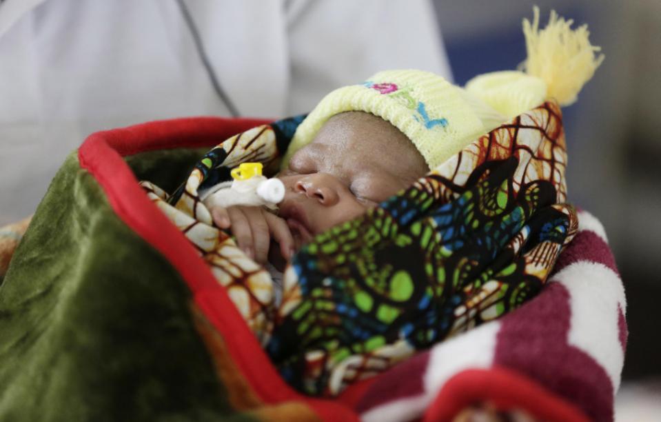 Approximately, 1 Under-5 Child Dies Every 20 Minutes in Sierra  Leone