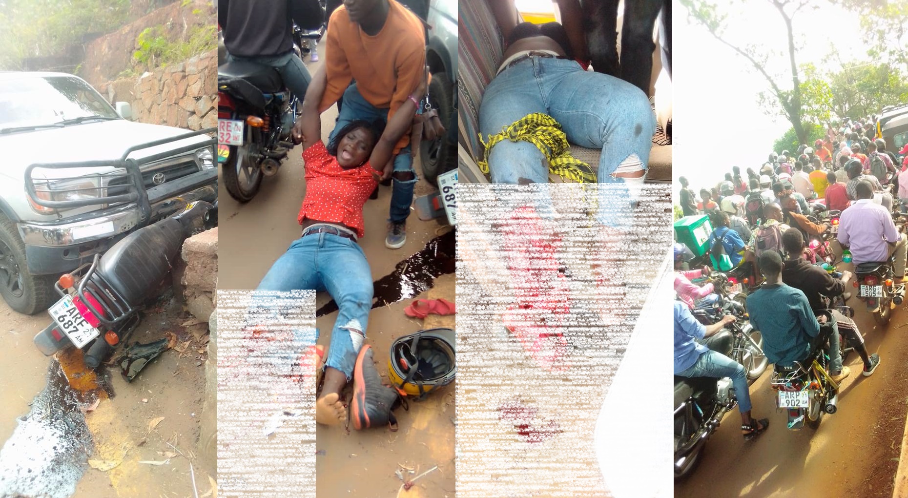 Jeep Crushes Fourah Bay College Student in Freetown, Breaks Her Leg (Viewers’ Discretion)