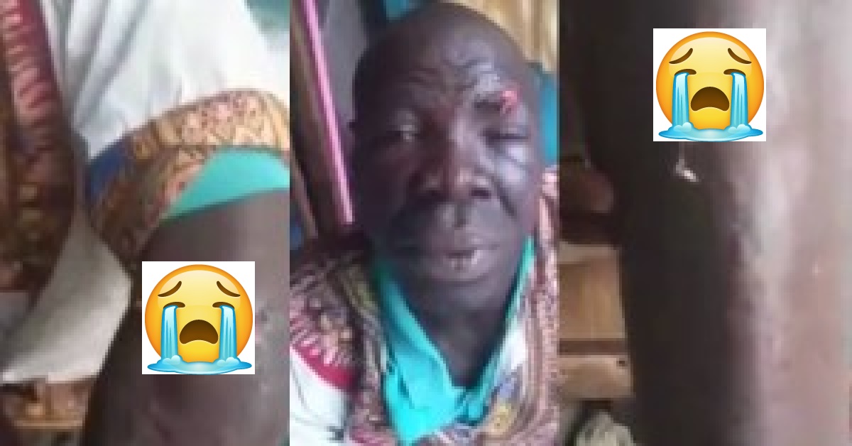 Blacker Tortured by SLPP Thugs