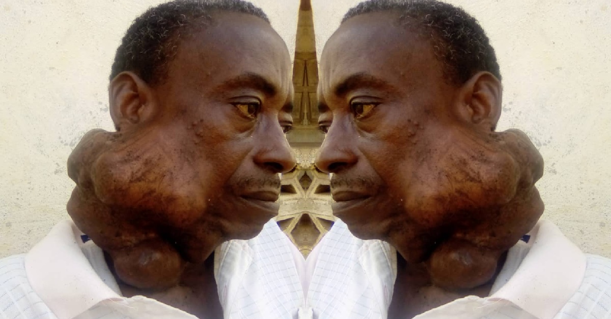 Sierra Leonean Teacher Suffering From Lipoma Disease Pleads For Help And Urgent Medical Attention
