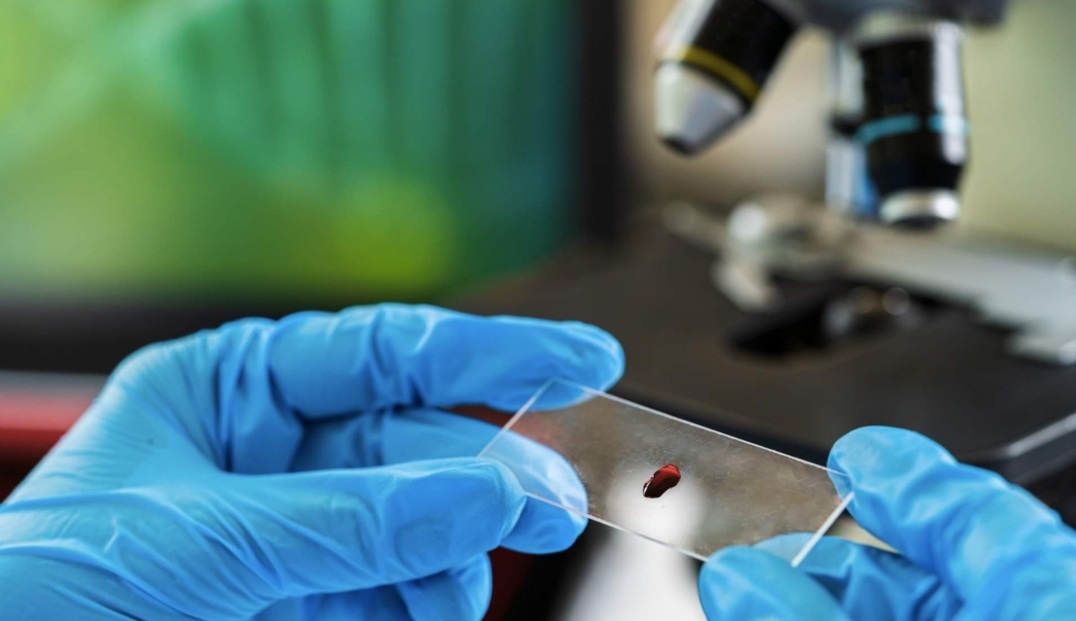 Doctors in the US Found New Cure for HIV