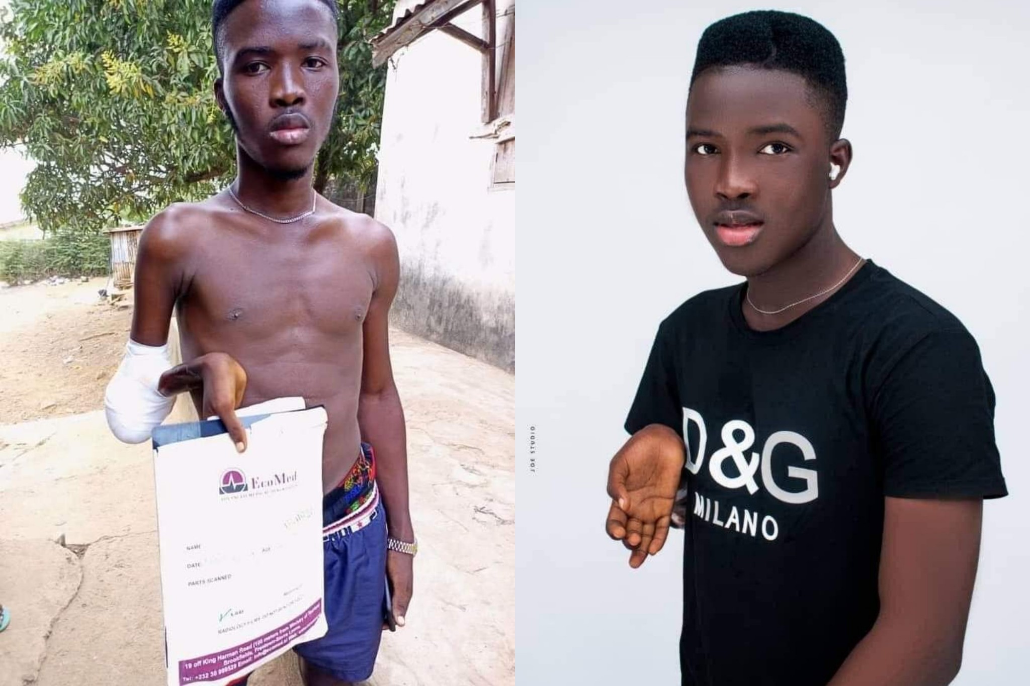 Young Sierra Leonean With Hand Cancer in Need of Urgent Financial Assurance