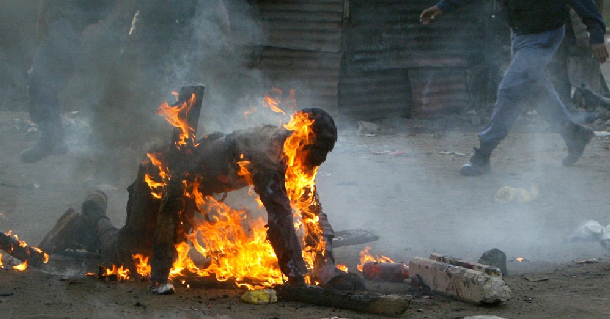 Fiancee Allegedly Burns Boyfriend