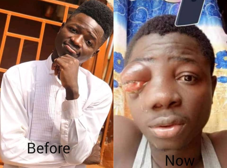 Promising Young Sierra Leonean Man Pleads For Support And Urgent Medical Attention