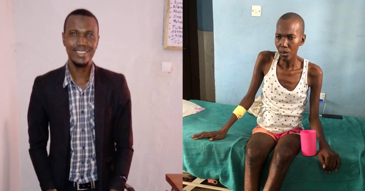 34 Years Old Sierra Leonean in Need of Urgent Financial Support for Liver Transplant in India