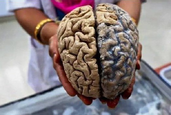 9 Common Daily Habits That Damage The Brain
