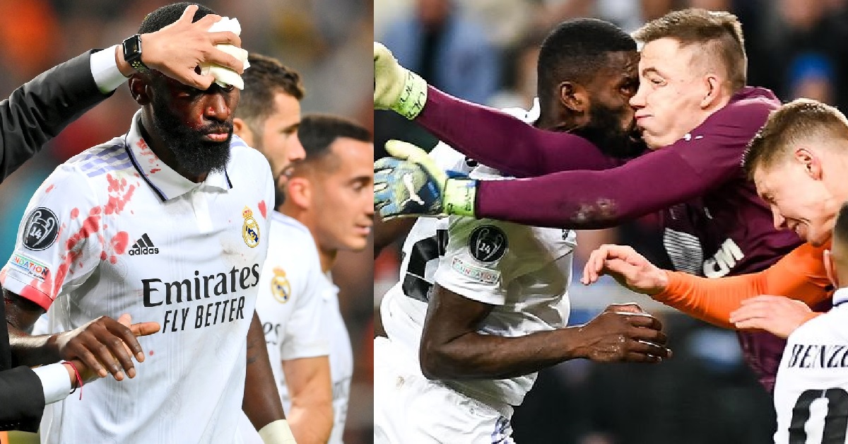 Bloodied Antonio Rüdiger Reacts After a Gruesome Head Clash to Secure a Draw For Real Madrid