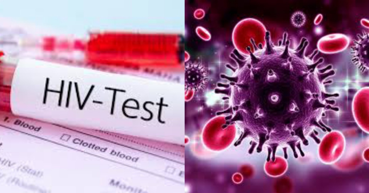 HIV And AIDS Faced With Low Funding