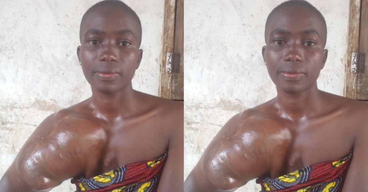 Woman With Swollen Limb Calls For Help