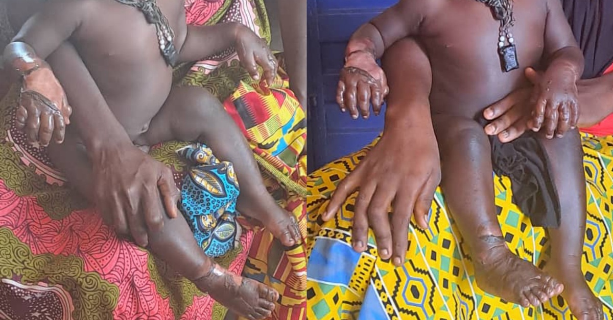 Father Allegedly Dumps One-Year-Old Child in Hot Water