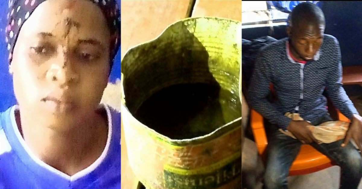 Pregnant Wife Allegedly Pours Acid on Husband’s Eyes