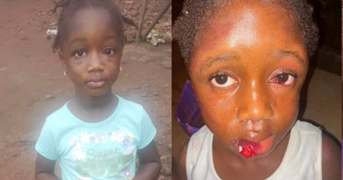 Caregiver Debunks Alleged Death of 5-Year-Old Girl