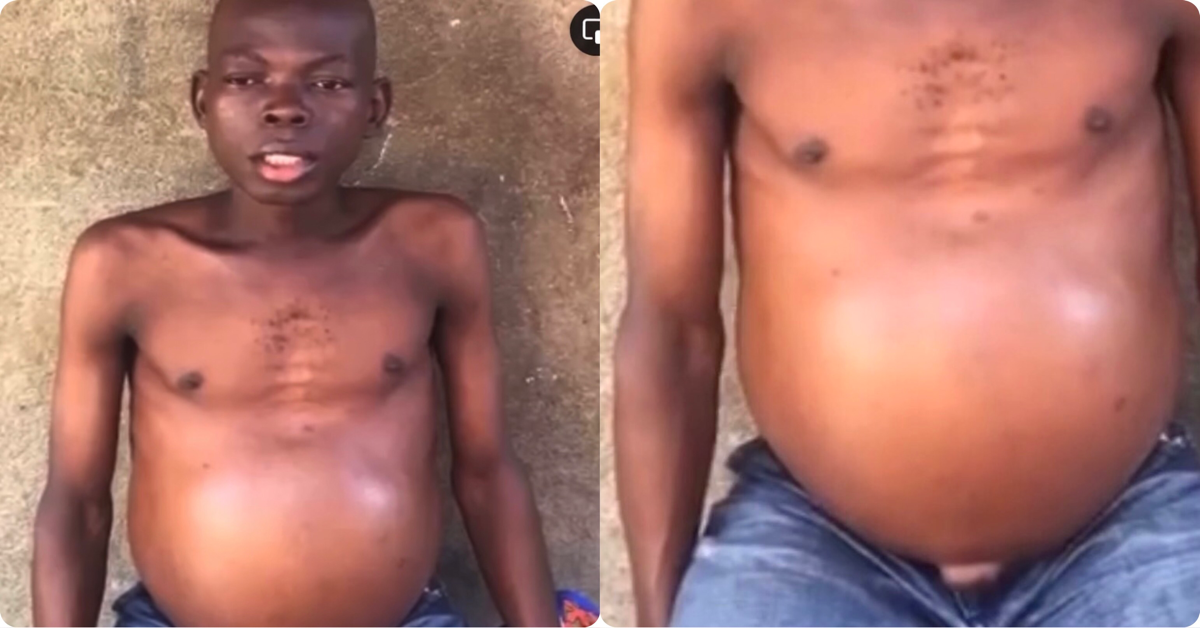 Ailing Charles Boima Seeks Support For Urgent Liver Treatment