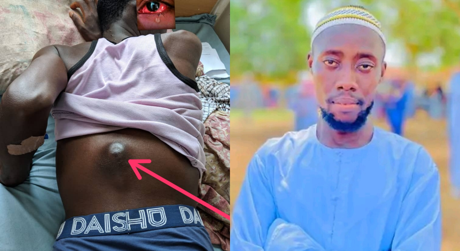 Man With Severe Health Condition Cries For Help