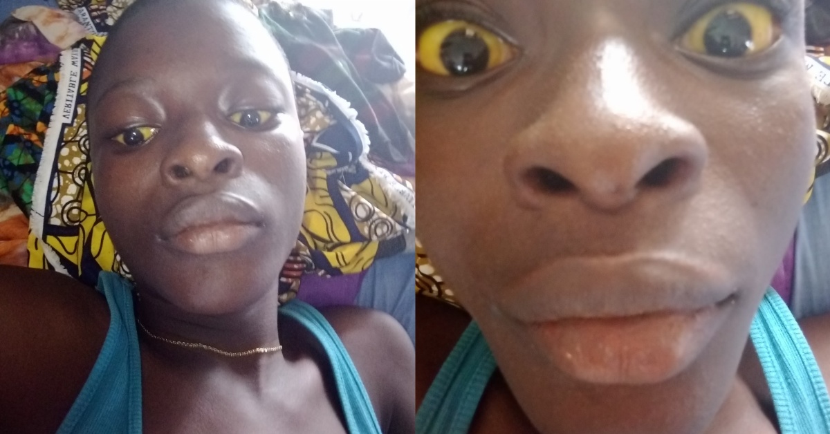 Single Mother Appeals For Help as Son Battles Liver Problem in Pujehun District