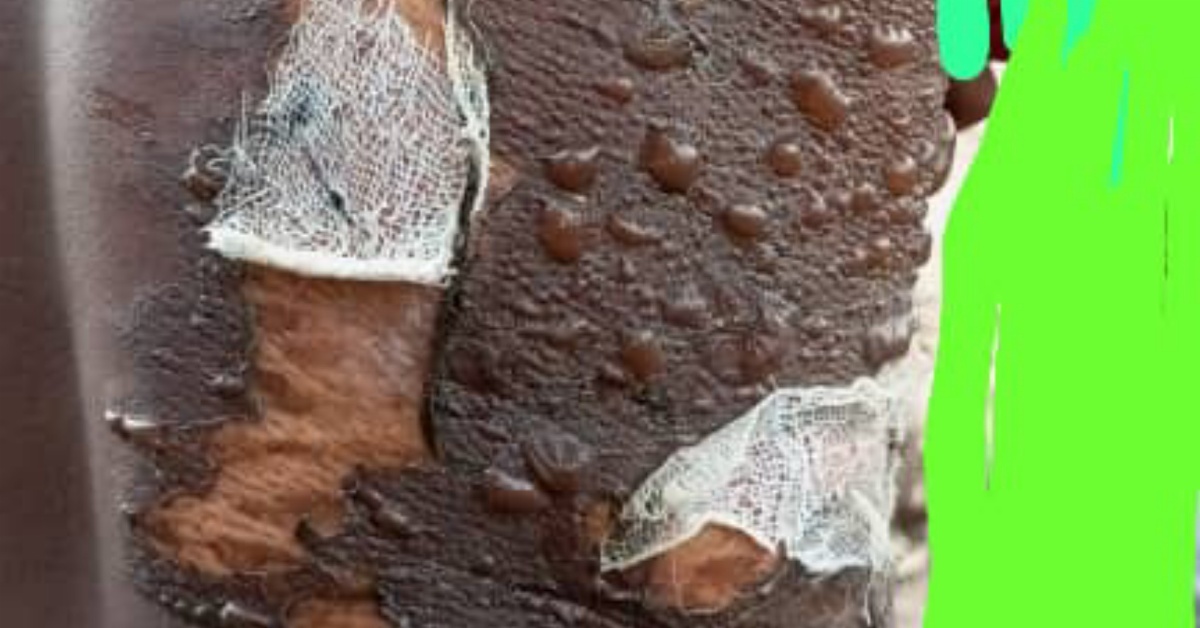 Pujehun District Logistics Officer Under Police Investigation for Alleged Assault on 15-Year-Old House Help