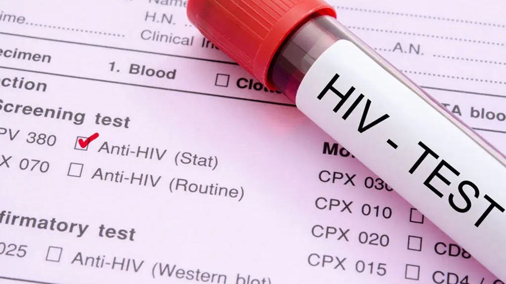 Understanding HIV and Its Early Symptoms