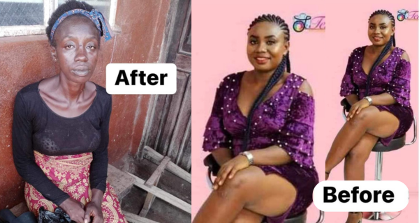 Viral Photos Spark Concern Over Kush Addiction in Sierra Leone