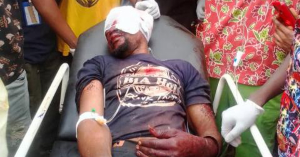 Attack on Security Guard Raises Safety Concerns in Sumbuya Lugbu
