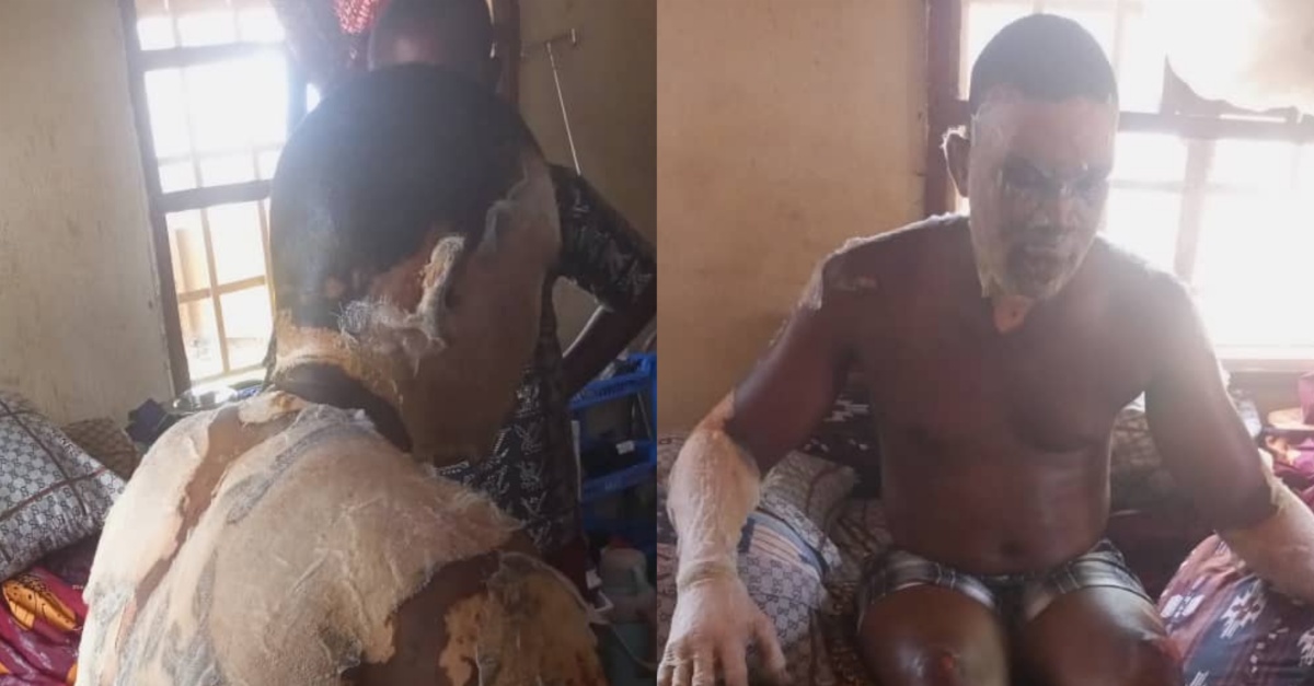 Police Officer Sustains Serious Burns While Rescuing a Motorist From a Burning Vehicle