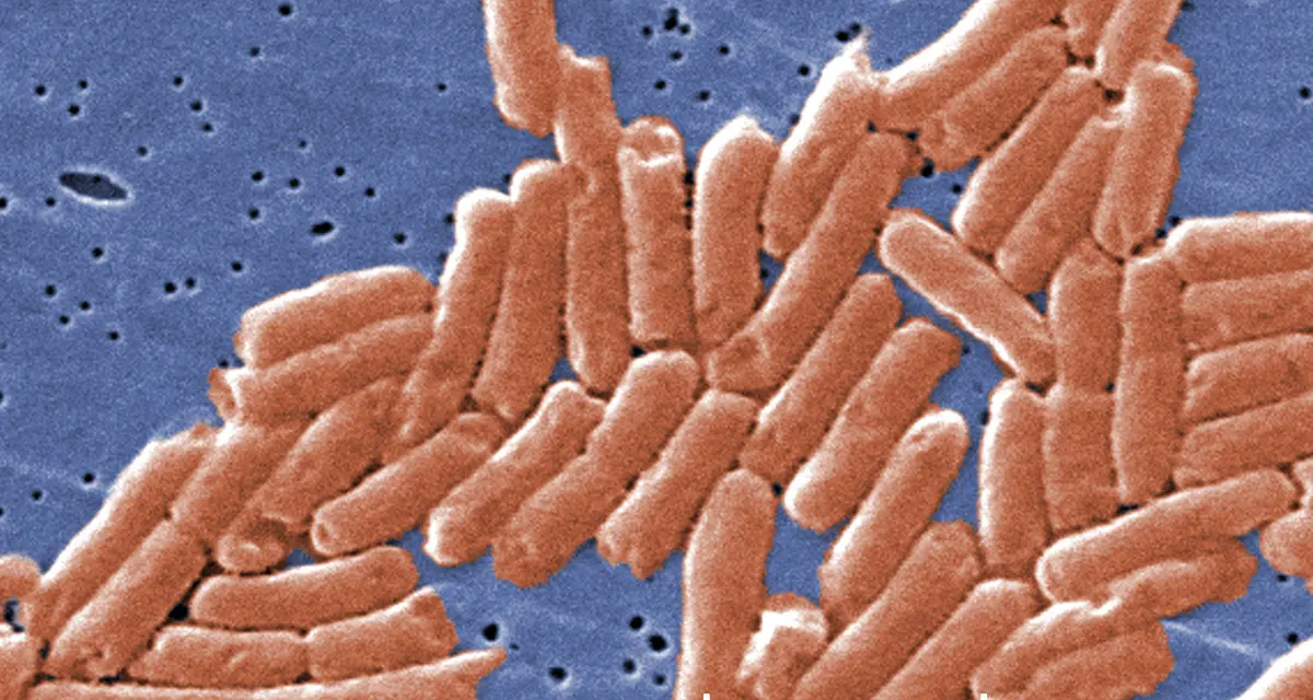 Sierra Leone Confirms Cases of Salmonella Diarrhoeal Illness in Falaba