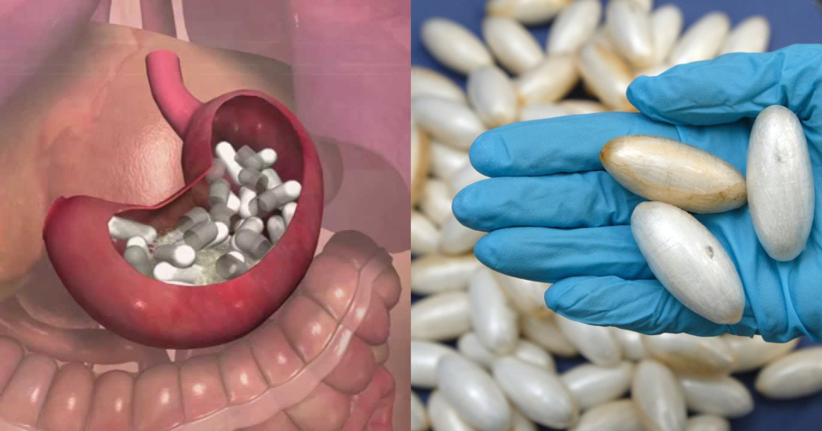 Over 70 Wraps of Cocaine Removed From Stomach of Sierra Leonean National at Indian Airport