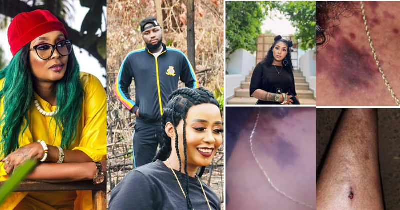 Musician Star Zee And Husband Allegedly Brutalized by Police in Freetown