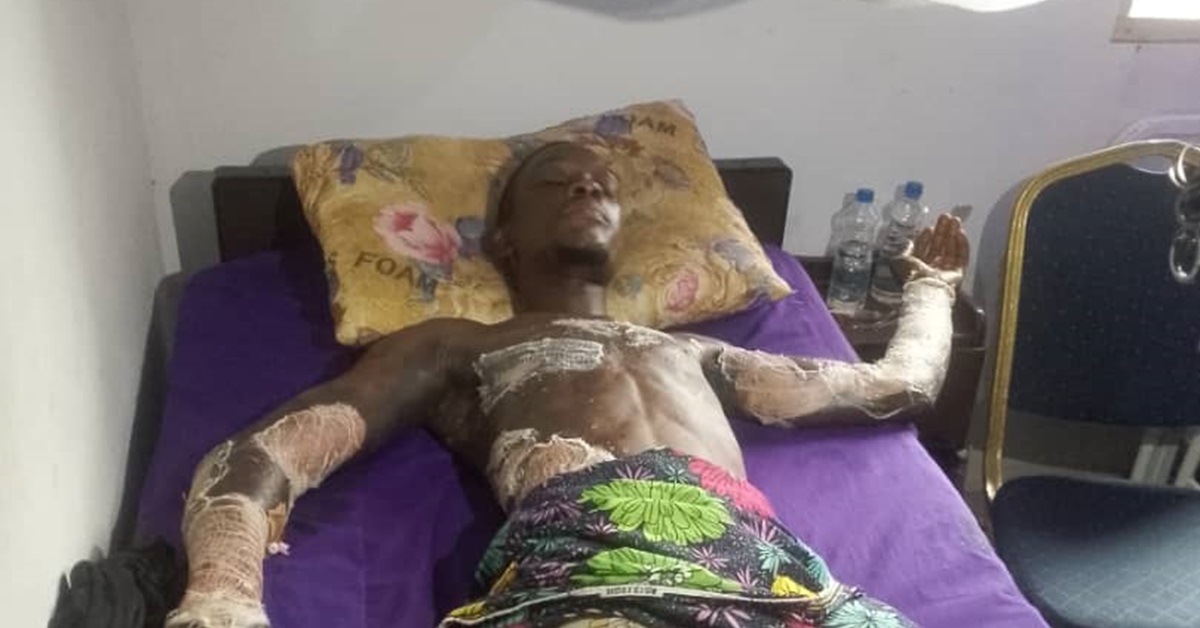 Boy Dies After Father Douses Him in Petrol and Sets Him Ablaze