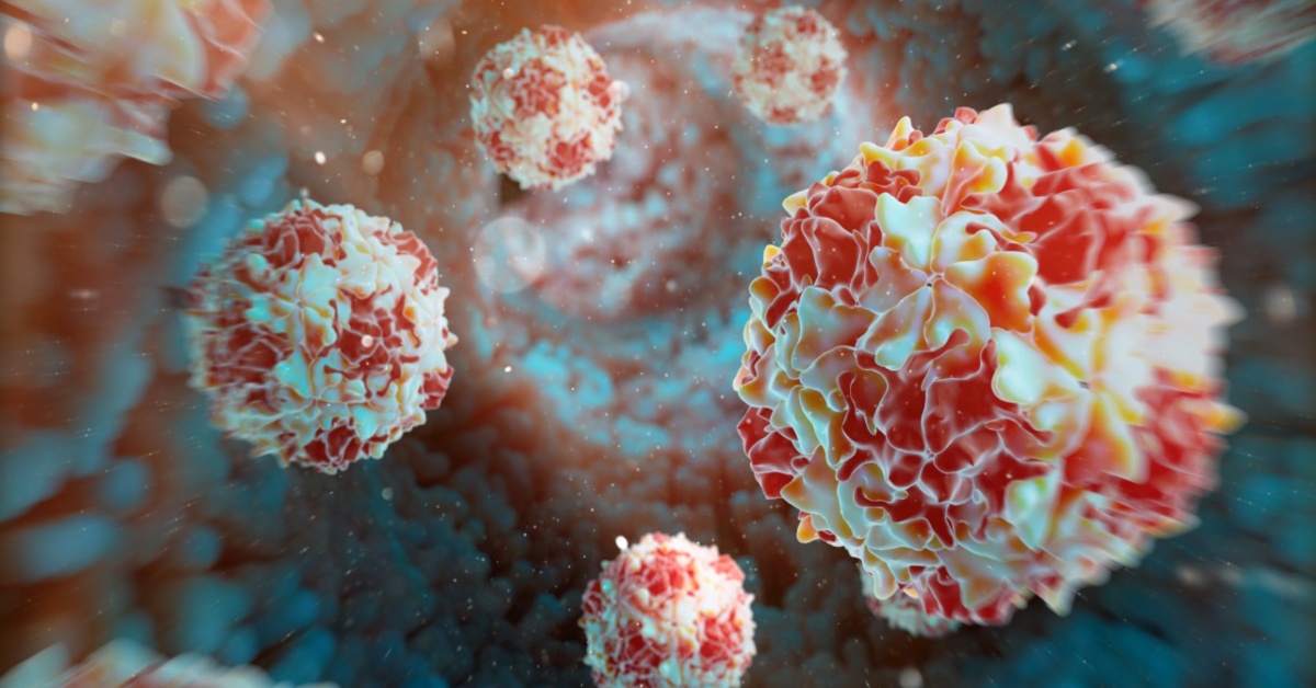 Sierra Leone Confirms First Case of Type 2 Polio Virus in Three Years