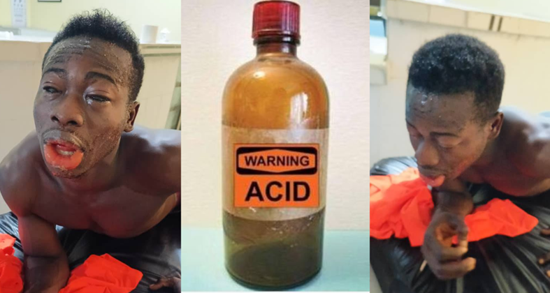 In Mile 91: Man Pours Acid on His Colleague in Dispute Over a Woman