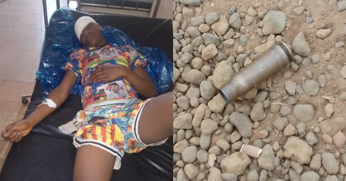 OSD Officer Allegedly Injures Youth with Gunshots During Riot in Malal Chiefdom, Tonkolili District