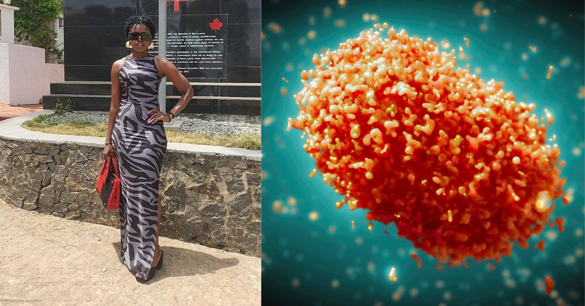 Hawa Hunt Confirms Mpox Infection