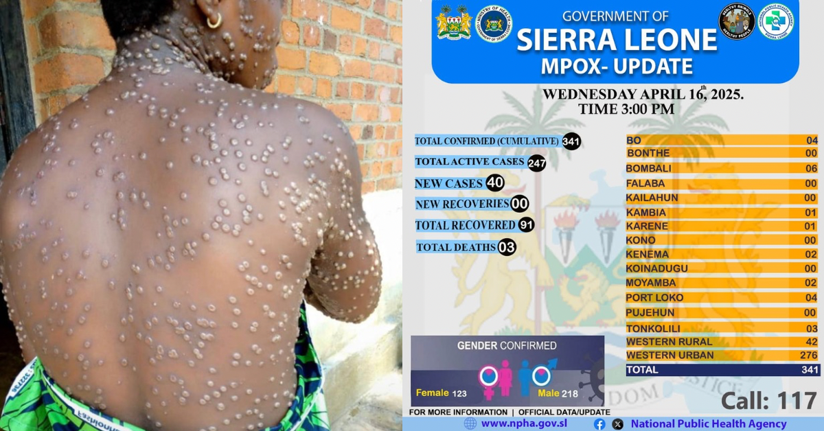 Sierra Leone Confirms 32 New MPOX Cases and Three Deaths