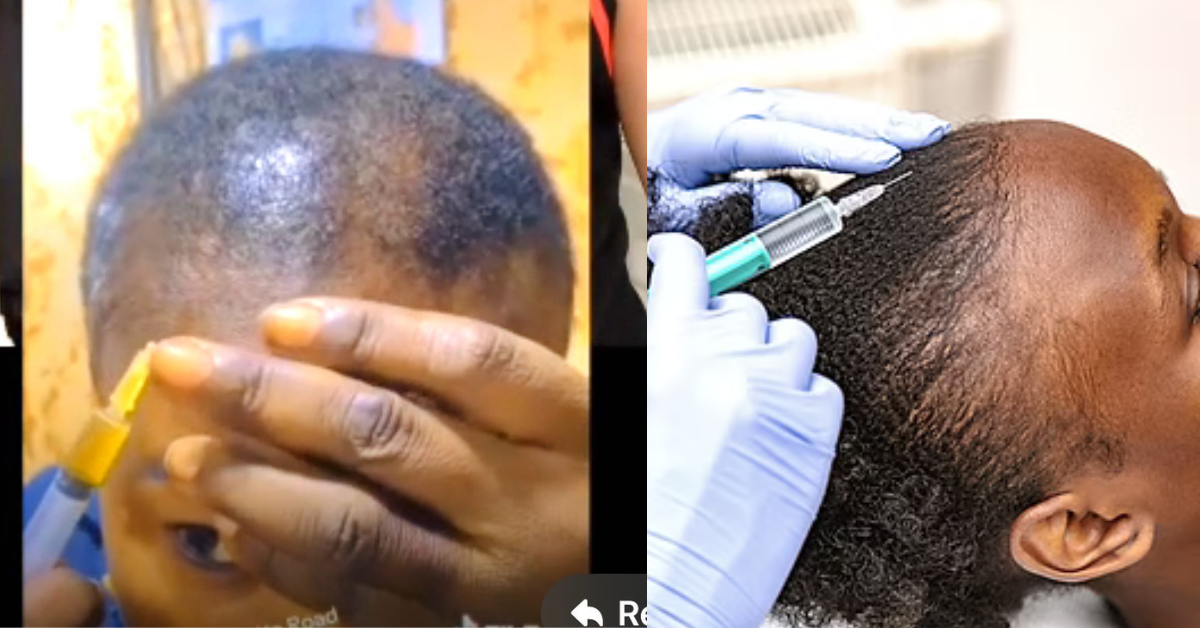 Viral Video of Woman Performing PRP Treatment Sparks Public Outcry and Calls for Health Ministry Intervention