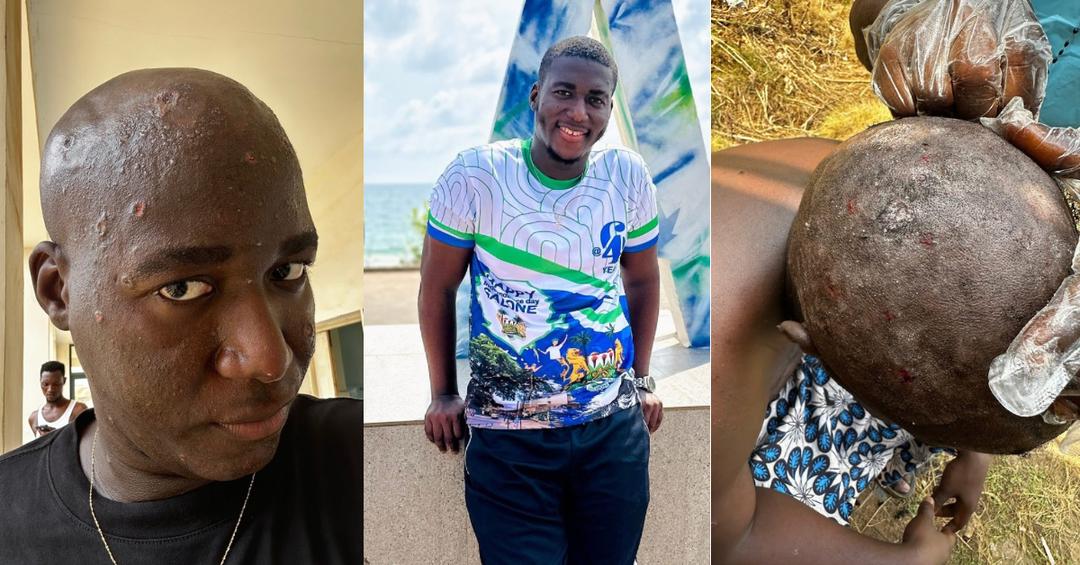 Popular Youth Activist Black Coffee Shares Harrowing Experience After Contracting Mpox, Calls for Greater Public Awareness