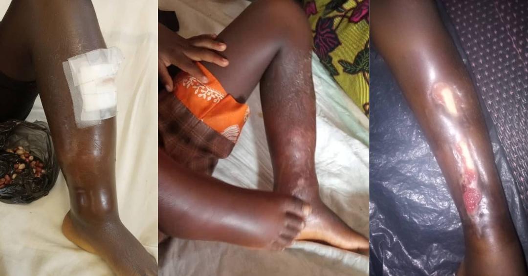 Life-Saving Surgery: Family of 5-Year-Old Girl Appeals for Financial Support