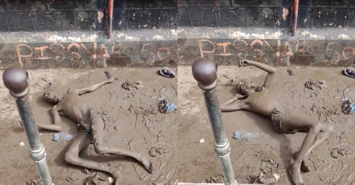 Angry Citizens Inject Acid on Suspected Thief in Freetown