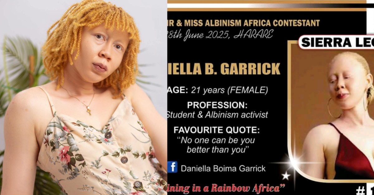 Daniella Boima Garrick to Represent Sierra Leone at Mr & Miss Albinism Africa 2025