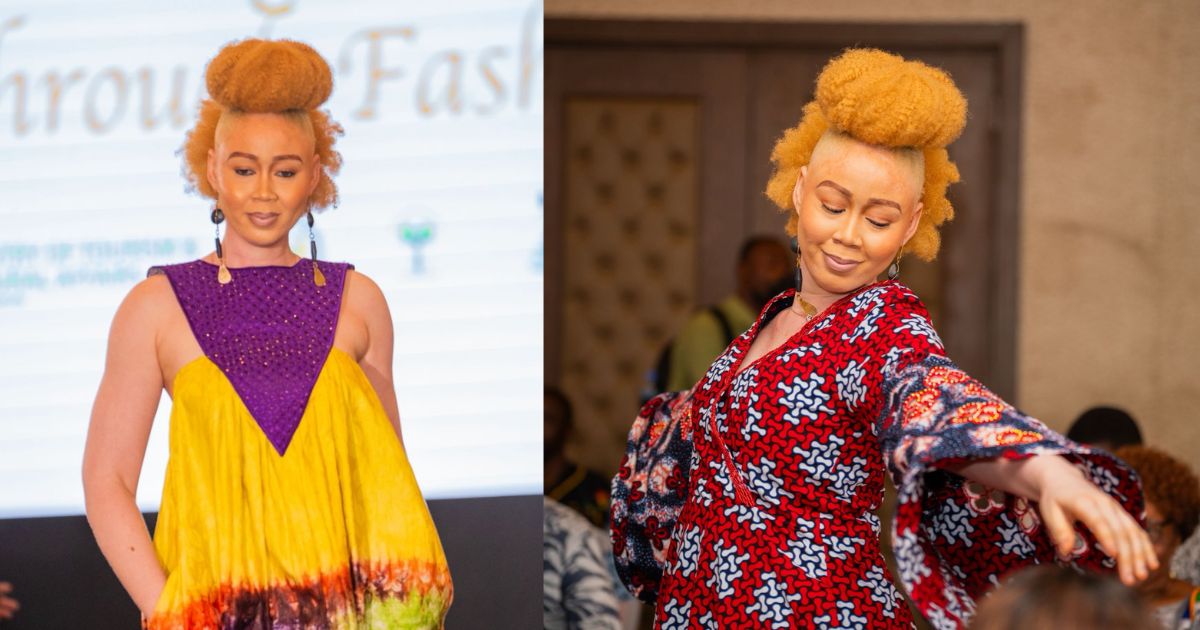 Sierra Leone’s Daniella Boima Garrick Crowned Miss Albinism Africa 2025