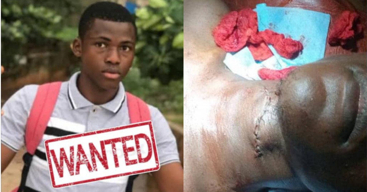 Police Launch Manhunt for Sulaiman Jalloh After Knife Attack in Deep Eye Water