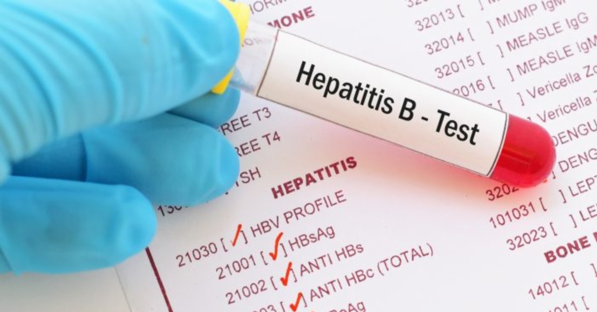 Bo, Kono, Tonkolili, Port Loko, and Western Rural Lead in Hepatitis B Cases, New Data Reveals