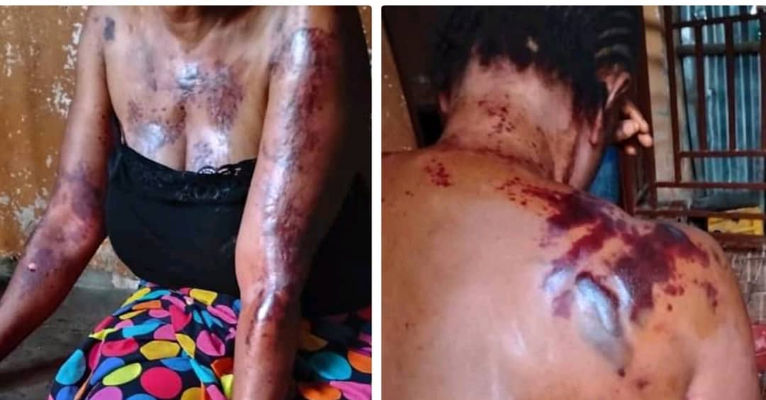 Man Accused of Beating Wife Mercilessly Just Months After Marriage