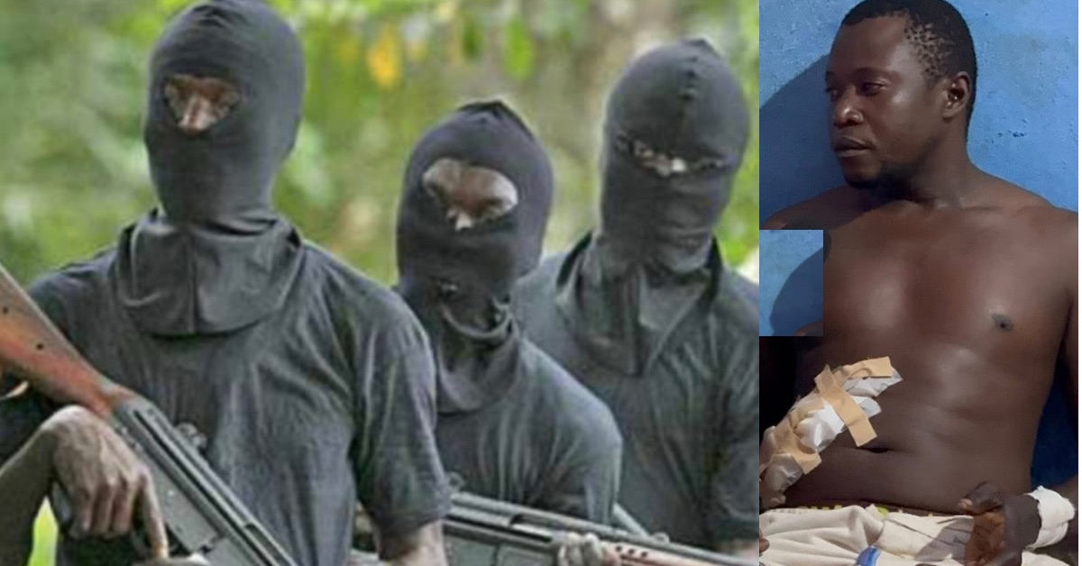 Armed Robbers Break Into Home in Sumaila Town, Shoot Husband and Injure Wife