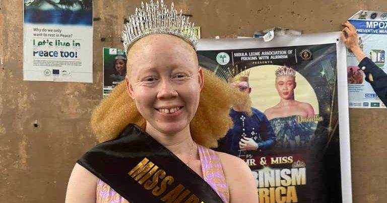 Miss Albinism Africa 2025 Daniella Garrick and Runner-Up Hamid Return to Sierra Leone After Harare Festival
