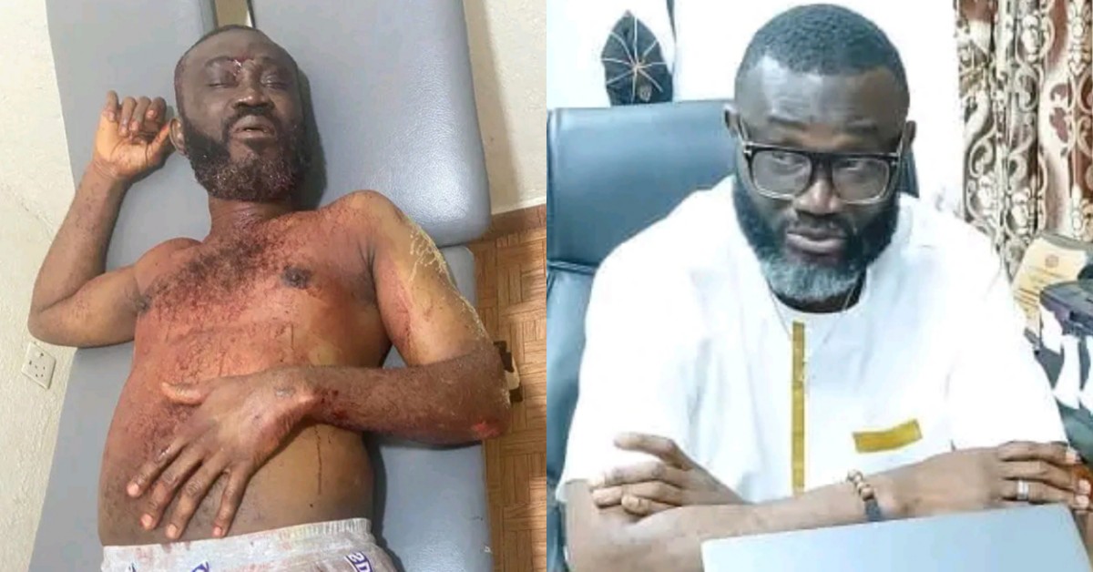 NASSIT Regional Manager Attacked by Armed Robbers in Bo Town