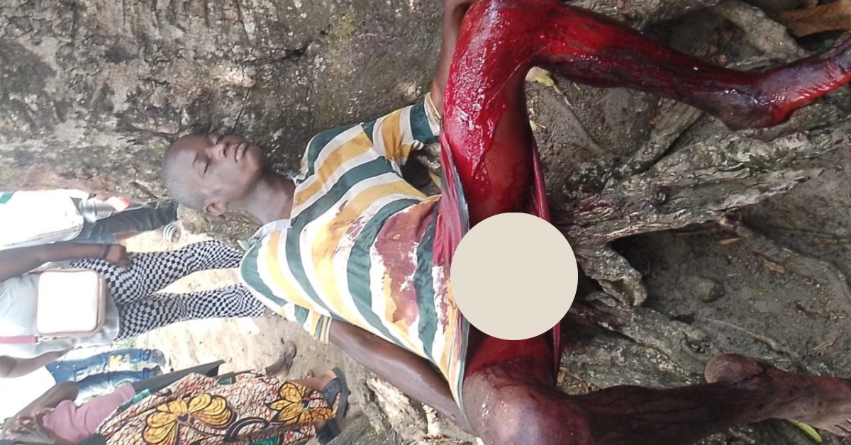 28-Year-Old Drug Addict Cuts Off His Manhood Over Economic Hardship in Bo Town