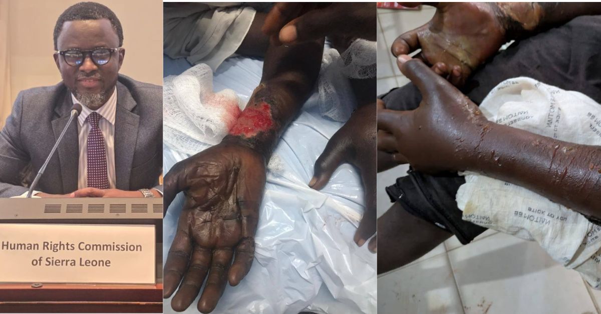 HRCSL Intervenes After 10-Year-Old Girl Tied for Three Days, 6-Year-Old Boy Risks Amputation