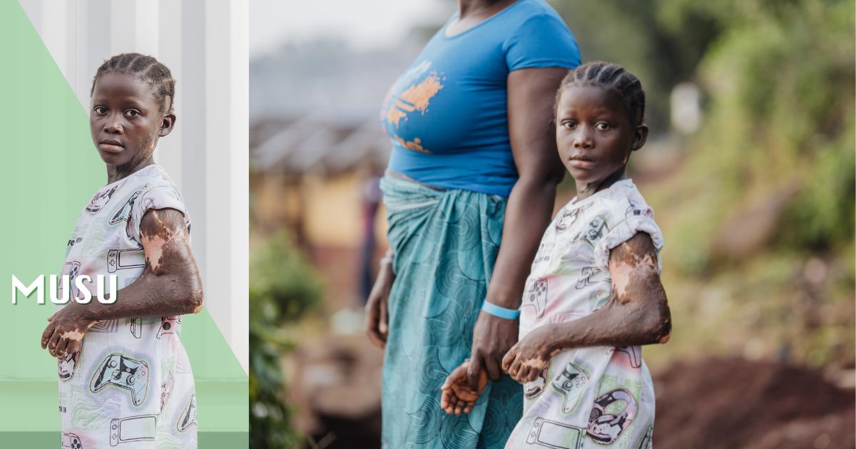 Inside The Mercy Ships Surgery That Straightened Musu’s Arm and Reclaimed Her Smile