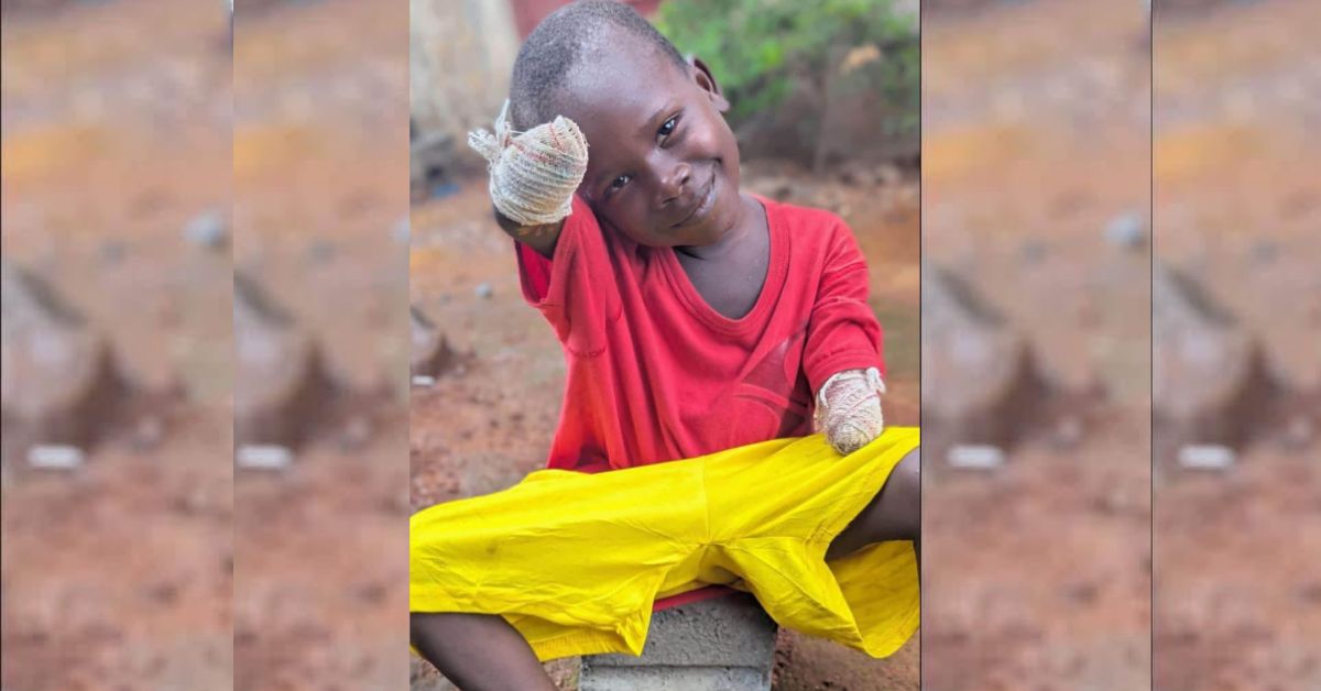 6-Year-Old Boy Loses Both Hands After Alleged Assault by Grandfather