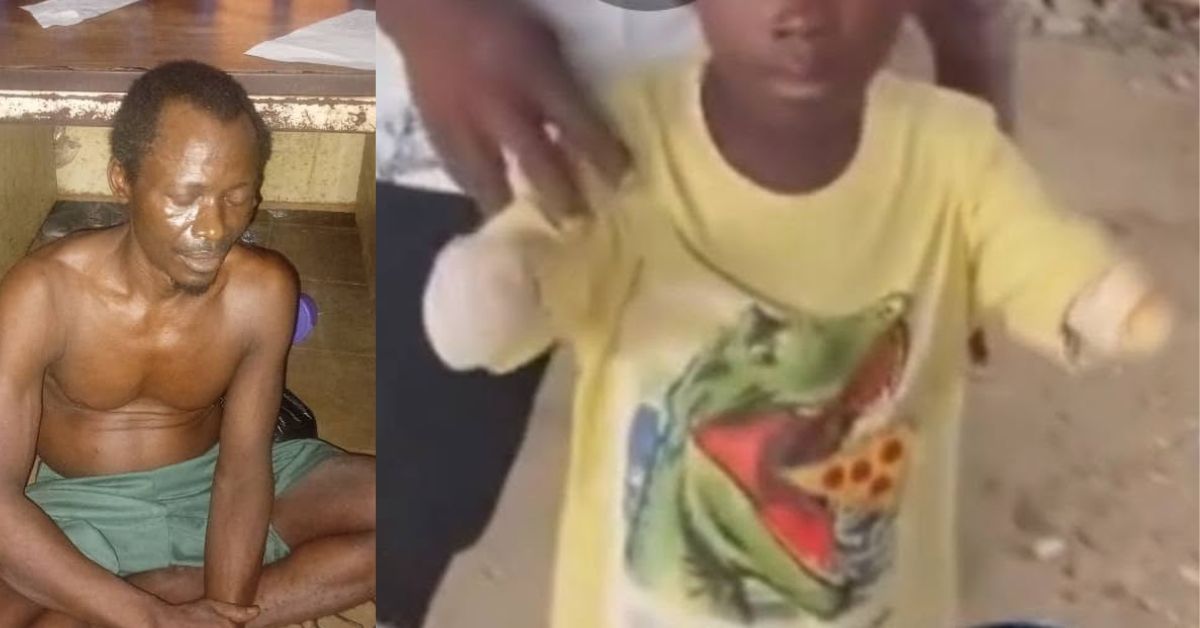 6-Year-Old Boy Reportedly Amputated After Severe Injuries From Grandfather